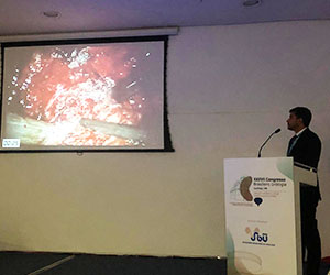 Apresentação no Congresso Brasileiro de Urologia, Sobre Casos complexos em cirurgia robótica para câncer de próstata